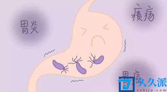 胃感染幽门螺杆菌有什么影响(胃感染幽门螺杆菌是什么症状)